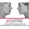  Trattamento facciale - Miolifting - metodo naturale